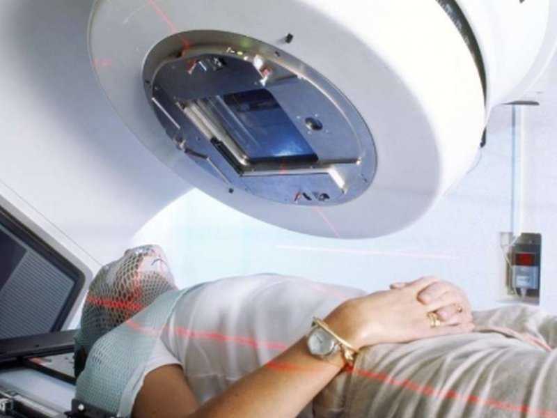 Канадские ученые назвали лучевую терапию самым безопасным методом лечения рака ротоглотки