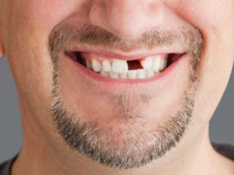 Обнаружены клетки, позволяющие выращивать новые зубы