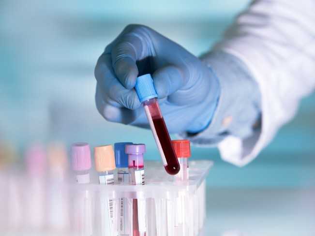 Какая группа крови наиболее уязвимая к новому виду коронавируса - Новости