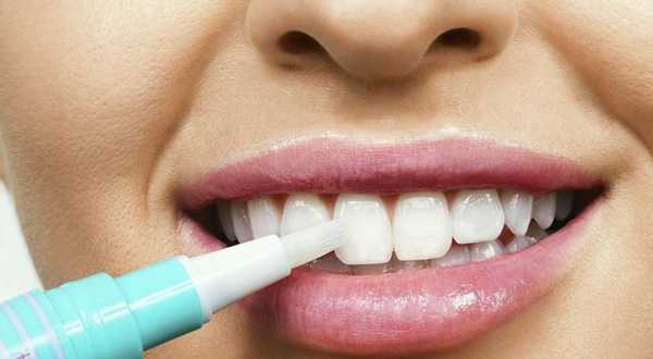Что стоит знать про отбеливание зубов