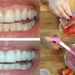 Как отбелить зубы клубникой